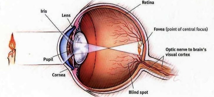 Cornea Transplant
